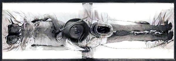 I presunti resti mummificati di Kap Dwa il gigante a due teste