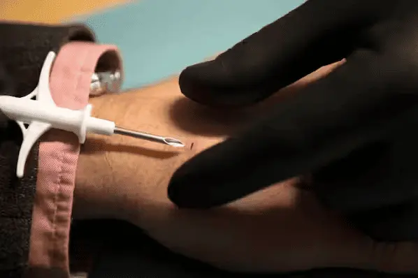 Impianto microchip sottocutaneo RFID in mano