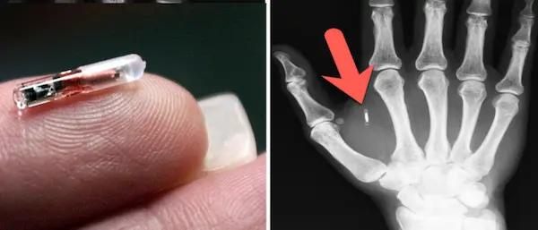 Microchip vs RX mano